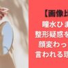【画像比較】瞳水ひまりの整形疑惑を調査！顔変わった？と言われる理由５選