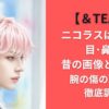 【＆TEAM】ニコラスは整形？目･鼻を昔の画像と比較！腕の傷の理由も徹底調査